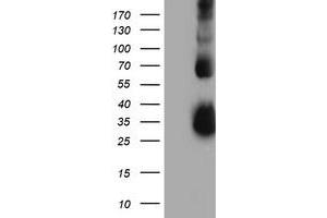HEK293T cells were transfected with the pCMV6-ENTRY control (Left lane) or pCMV6-ENTRY TIMP2 (Right lane) cDNA for 48 hrs and lysed. (TIMP2 antibody)