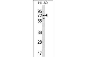 Western blot analysis in HL-60 cell line lysates (35ug/lane). (MBTD1 antibody  (C-Term))