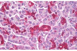 Anti-ABCD1 antibody IHC staining of human pancreas. (ABCD1 antibody)