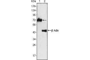 Western blot analysis using ZAP70 mouse mAb against Jurkat cell lysate (1). (ZAP70 antibody)