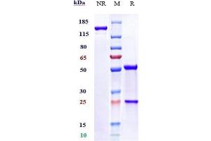 Anti-B7-H5 / VISTA Reference Antibody (onvatilimab) on SDS-PAGE under reducing (R) condition. (Recombinant VISTA (Onvatilimab Biosimilar) antibody)