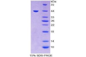 SDS-PAGE (SDS) image for Matrix Gla Protein (MGP) (AA 20-103) protein (His tag,GST tag) (ABIN2123250)