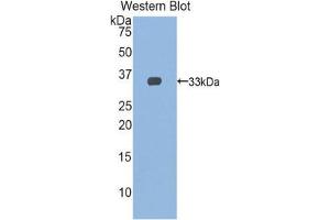 Western Blotting (WB) image for anti-Slow Skeletal Troponin T (TNNT1) (AA 1-261) antibody (ABIN1860820) (TNNT1 antibody  (AA 1-261))