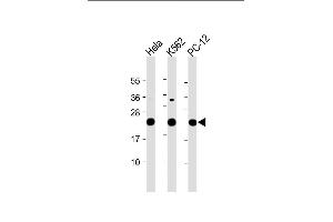 All lanes : Anti-LZIC Antibody (Center) at 1:2000 dilution Lane 1: Hela whole cell lysate Lane 2: K562 whole cell lysate Lane 3: PC-12 whole cell lysate Lysates/proteins at 20 μg per lane. (LZIC antibody  (AA 81-109))