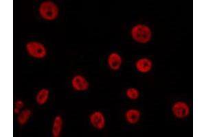 ABIN6266668 staining 293 by IF/ICC. (UBA2 antibody  (C-Term))