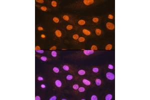 Immunofluorescence analysis of H9C2 cells using POLR2A Rabbit pAb (ABIN3022932, ABIN3022933, ABIN3022934 and ABIN6219303) at dilution of 1:100. (POLR2A/RPB1 antibody  (AA 1-260))
