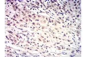 Immunohistochemistry (IHC) image for anti-HtrA Serine Peptidase 2 (HTRA2) (AA 278-458) antibody (ABIN7193389)