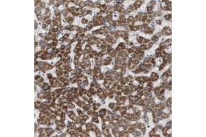 Immunohistochemical staining of human stomach with MARC2 polyclonal antibody  shows strong cytoplasmic positivity in glandular cells.