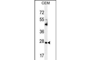 TIMP1 antibody  (C-Term)