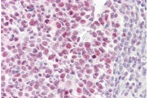 Anti-PIAS4 antibody IHC staining of human tonsil. (PIAS4 antibody  (AA 451-500))