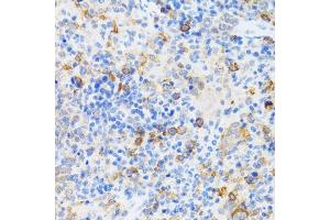 Immunohistochemistry of paraffin-embedded mouse spleen using p60 C antibody  at dilution of 1:100 (40x lens). (CHAF1B antibody  (AA 270-559))
