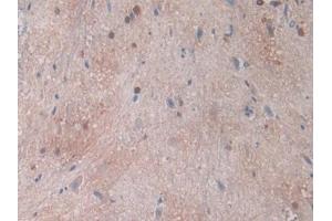 Immunohistochemistry (IHC) image for anti-Carbonic Anhydrase II (CA2) (AA 1-260) antibody (ABIN7438433)