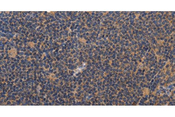 CCL23 antibody