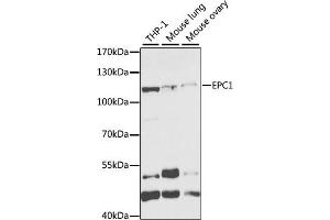 Western blot analysis of extracts of various cell lines, using EPC1 antibody (ABIN6133506, ABIN6140203, ABIN6140204 and ABIN6221494) at 1:1000 dilution. (EPC1 antibody  (AA 1-300))
