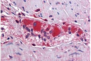 Human Colon, Myenteric Plexus: Formalin-Fixed, Paraffin-Embedded (FFPE) (KCNJ8 antibody  (C-Term))