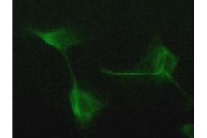Immunofluorescence (IF) image for anti-Vimentin (VIM) antibody (ABIN1109487) (Vimentin antibody)