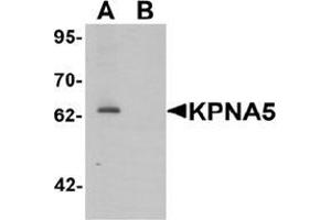 Western blot analysis of KPNA6 in EL4 cell lysate with KPNA5 Antibody  at 1 μg/mL in (A) the absence and (B) the presence of blocking peptide. (KPNA5 antibody  (N-Term))