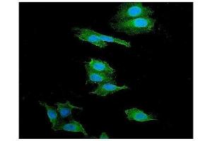 anti-Catenin (Cadherin-Associated Protein), alpha 1, 102kDa (CTNNA1) (AA 143-292) antibody