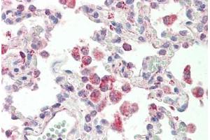 Human Lung: Formalin-Fixed, Paraffin-Embedded (FFPE) (GLRA1 antibody  (AA 373-386))