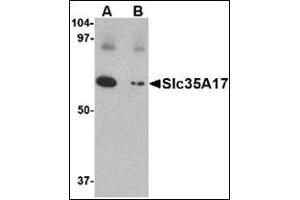 Western blot analysis of Slc22A17 in SK-N-SH lysate with this product at 1 μg/ml in (A) the absence and (B) the presence of blocking peptide. (SLC22A17 antibody  (C-Term))