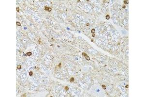 Immunohistochemistry of paraffin-embedded Mouse brain using TPPP Polyclonal Antibody at dilution of 1:100 (40x lens). (Tppp antibody)