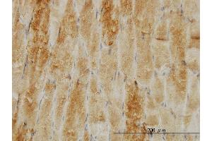 Immunoperoxidase of monoclonal antibody to CFL2 on formalin-fixed paraffin-embedded human skeletal muscle. (Cofilin 2 antibody  (AA 57-166))