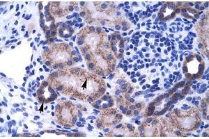 Human kidney; ZNF84 antibody - C-terminal region in Human kidney cells using Immunohistochemistry