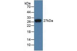 Detection of Recombinant FGF21, Human using Monoclonal Antibody to Fibroblast Growth Factor 21 (FGF21) (FGF21 antibody  (AA 29-209))