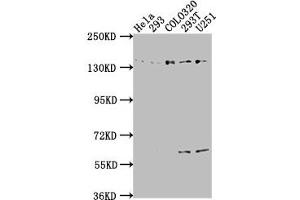 Western Blot Positive WB detected in: Hela whole cell lysate, 293 whole cell lysate, COLO320 whole cell lysate, 293T whole cell lysate, U251 whole cell lysate All lanes: ERC1 antibody at 1:2000 Secondary Goat polyclonal to rabbit IgG at 1/50000 dilution Predicted band size: 129, 114, 125, 109, 82 kDa Observed band size: 135 kDa (ERC1 antibody  (AA 1-224))