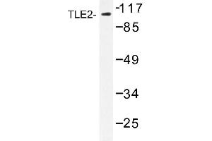 Image no. 1 for anti-Transducin-Like Enhancer Protein 2 (TLE2) antibody (ABIN272212) (TLE2 antibody)