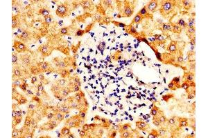 Immunohistochemistry (IHC) image for anti-Aldehyde Dehydrogenase 5 Family, Member A1 (ALDH5A1) (AA 48-535) antibody (ABIN7170921)