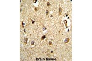 Immunohistochemistry (IHC) image for anti-Valosin Containing Protein (VCP) antibody (ABIN3002881)