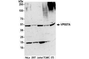 anti-Vacuolar Protein Sorting 37 Homolog A (VPS37A) (AA 200-250) antibody