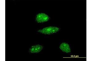 Immunofluorescence of monoclonal antibody to HEY1 on HeLa cell. (HEY1 antibody  (AA 121-220))