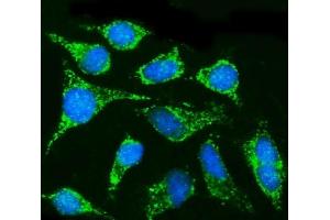IF analysis of CPT1B using anti-CPT1B antibody (ABIN7600359). (CPT1B antibody  (AA 180-772))