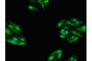 Immunofluorescent analysis of HepG2 cells using ABIN7171602 at dilution of 1:100 and Alexa Fluor 488-congugated AffiniPure Goat Anti-Rabbit IgG(H+L) (TBC1D15 antibody  (AA 283-404))