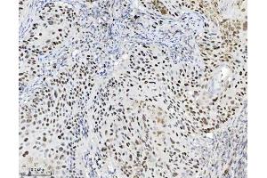 IHC analysis of MCM7 using anti-MCM7 antibody (ABIN7601968).