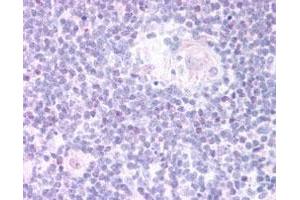 FOXN1 polyclonal antibody  staining (20 ug/mL) of paraffin embedded human thymus medulla. (FOXN1 antibody)