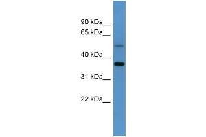 WB Suggested Anti-Gyg Antibody Titration:  0. (GYG antibody  (C-Term))
