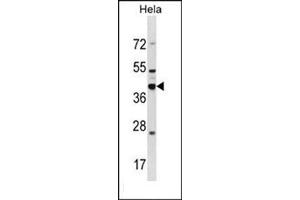 Western blot analysis of DND1 Antibody  in Hela cell line lysates (35ug/lane). (DND1 antibody  (Middle Region))