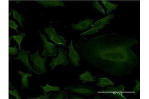 Immunofluorescence of monoclonal antibody to CYP1A2 on HeLa cell.