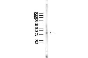 Western blot analysis of lysates from Rat liver, using POMC Antibody at 1/1000 dilution.