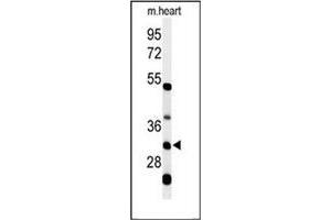 Western blot analysis of HCCS / CCHL Antibody (Center) in mouse heart tissue lysates (35ug/lane). (HCCS antibody  (Middle Region))