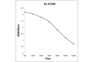 Antigen: 0. (VLDLR antibody  (AA 551-650))