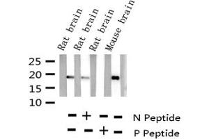 Western blot analysis of Phospho-Synuclein (Ser129) expression in various lysates (SNCA antibody  (pSer129))