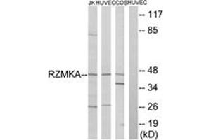Western blot analysis of extracts from HuvEc/COS/Jurkat cells, using RIMKA Antibody.