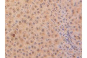 Immunohistochemistry (IHC) image for anti-Parkinson Protein 7 (PARK7) (AA 1-189) antibody (ABIN1078424)