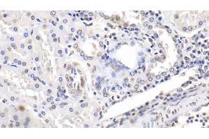 Detection of ENO1 in Human Kidney Tissue using Monoclonal Antibody to Enolase 1 (ENO1) (ENO1 antibody  (AA 1-434))