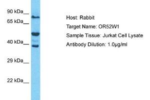 Host: Rabbit Target Name: OR52W1 Sample Type: Jurkat Whole Cell lysates Antibody Dilution: 1. (OR52W1 antibody  (C-Term))