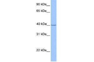 WB Suggested Anti-ZNF385D Antibody Titration:  0. (ZNF385D antibody  (N-Term))